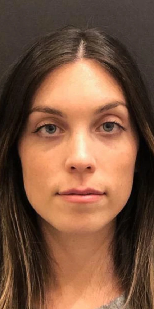 A women with smooth lines and wrinkles on her face after Botox treatment